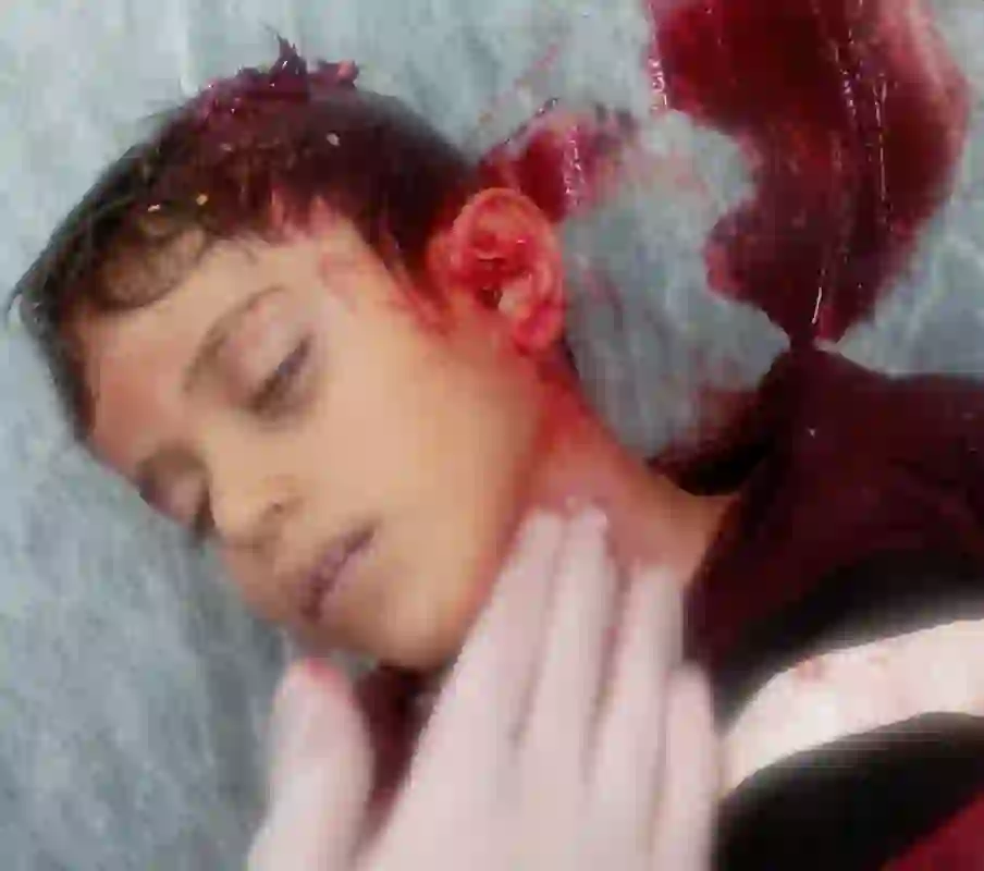 Child named Mustafa Halawanji killed by regime sniper’s shot in eastern Aleppo, November 5, 2023