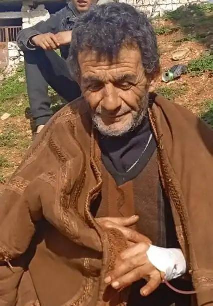 Civilian man named Mohammad Hashoum injured in a ground regime attack in S. Idlib, February 18, 2024