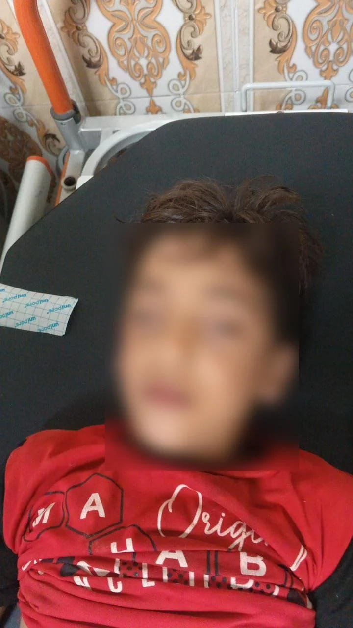 A 10-year-old boy, identified as Mohammad Nour from al-Halwanji village in the rural areas of Jarablos city in eastern Aleppo governorate, was shot dead on August 9, 2024, by a Syrian Democratic Forces (SDF) sniper near his family’s house in his home village. The area is under the control of the Syrian National Army (SNA).
The Syrian Network for Human Rights (SNHR) notes that the SDF has, through this act of killing, violated international human rights laws. The perpetrators must be held accountable.
Facebook
A boy named Mohammad Nour was shot dead on August 9 by a Syrian Democratic Forces (SDF) sniper near his family’s house in al-Halwanji village in eastern Aleppo governorate.
SNHR notes that the SDF has, through this act of killing, violated international human rights laws.
For more:
Twitter
A boy named Mohammad Nour was shot dead on Aug 9 by an SDF sniper near his family’s house in al-Halwanji village, E. Aleppo.
SNHR notes that the SDF has, through this act of killing, violated international human rights laws.
For more:
Title
Boy named Mohammad Nour shot dead by an SDF sniper in E. Aleppo, August 9, 2024